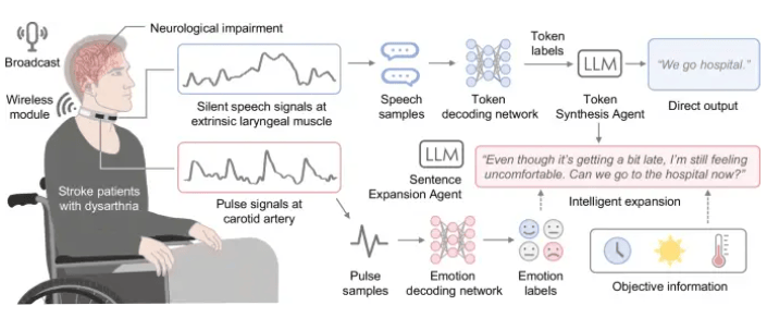 图示:为中风构音障碍患者开发的 IT 示意图。