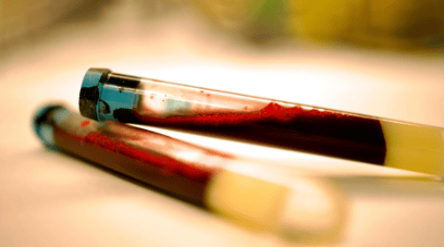 图片显示的是一份准备进行实验室检测的血液样本。