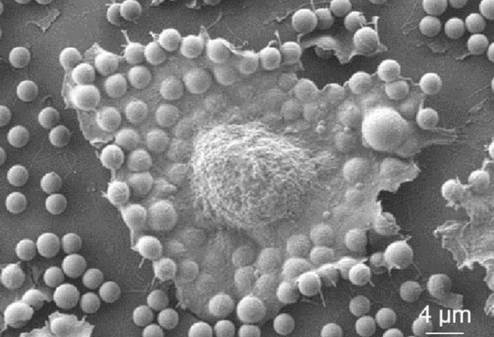 细胞表面:电子显微镜图像显示癌细胞在粘附表面时抓取颗粒。