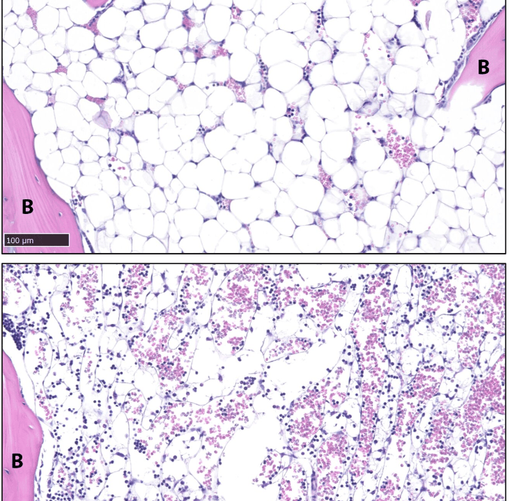 称为稳定脂肪细胞的脂肪细胞(上图白色显示)在小鼠治疗九天后从骨头(B)中完全耗尽,如下方图片所示。