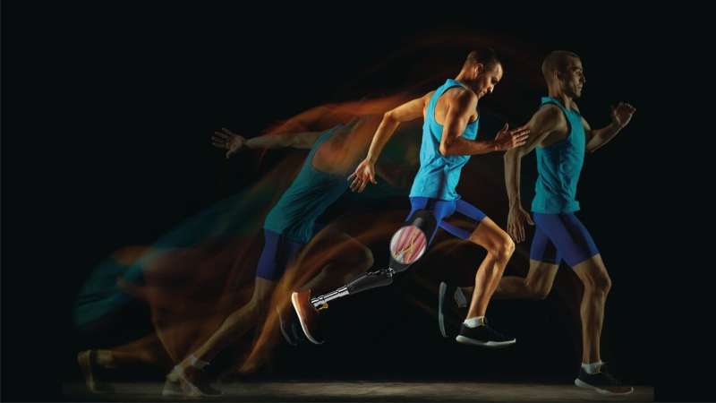 Direkte Verknüpfung mit dem Nervensystem verspricht natürlichere Beinprothesen