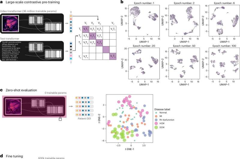 AI model reads cardiac MRI scans with near expert accuracy