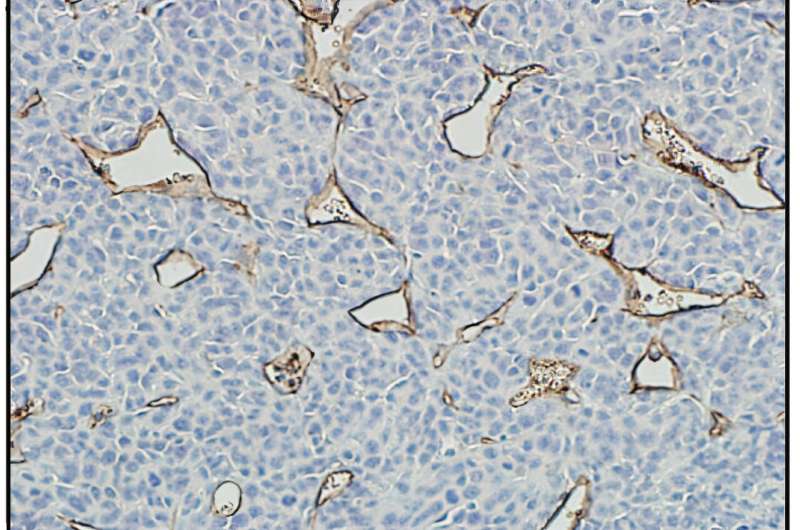 First-in-class dual HIF inhibitors eliminate breast, colorectal, melanoma, and prostate tumors in mice when combined with immunotherapy